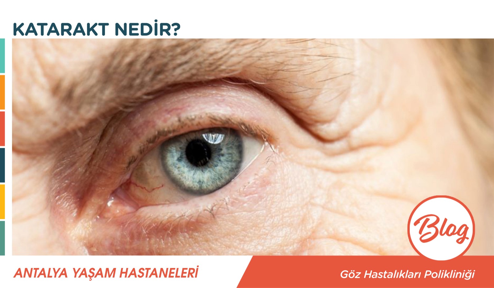 What is cataract?